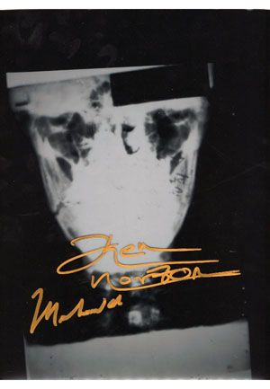 Muhammad Ali & Ken Norton Dual Autographed X-Ray of Alis Broken Jaw (JSA)
