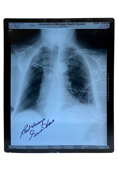 Gordie Howes Signed Personal Hospital Chest X-Ray (Full JSA)